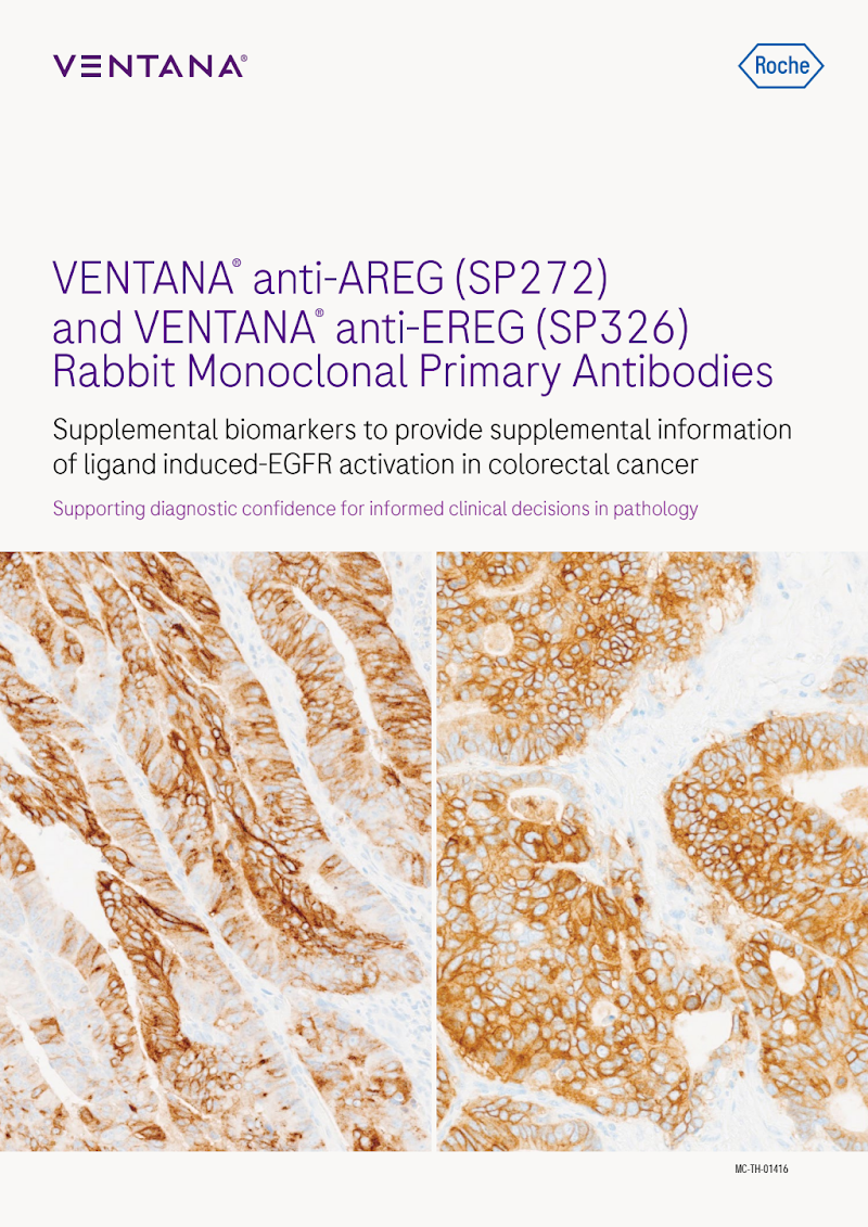 VENTANA AREG & EREG Rabbit Monoclonal Primary Antibodies