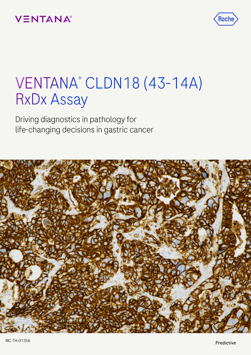 VENTANA CLDN18 (43-14A) RxDx Assay