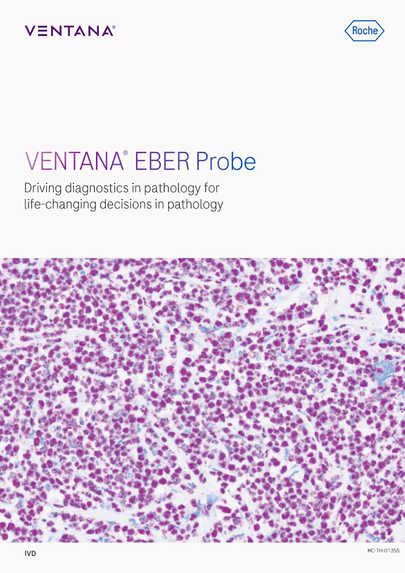 VENTANA EBER Probe