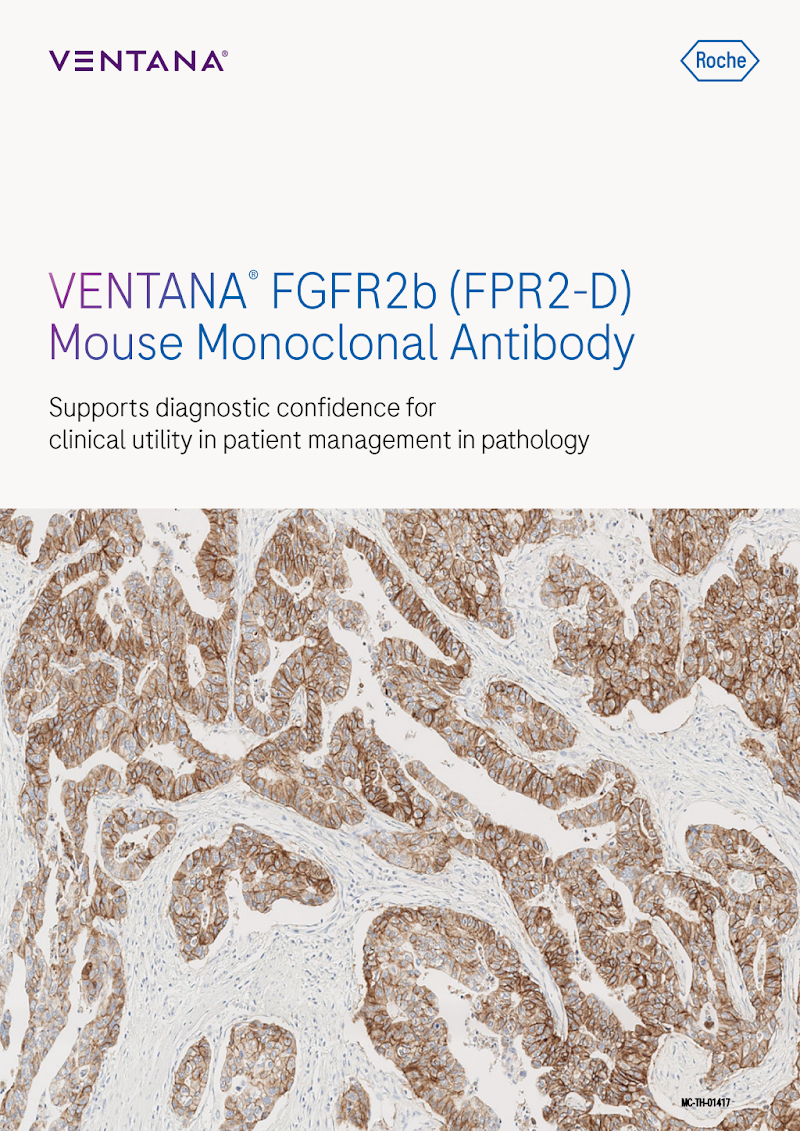 VENTANA FGFR2b (Class 1) Analytic Brochure