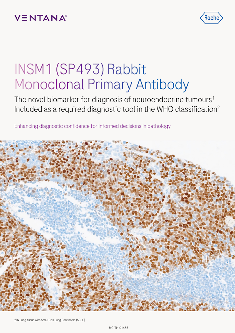 VENTANA INSM1 (SP493) Rabbit Monoclonal Primary Antibody
