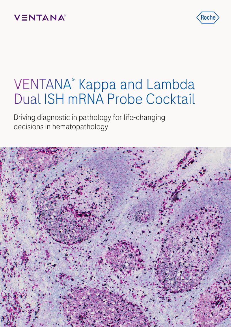 VENTANA Kappa & Lambda Dual ISH