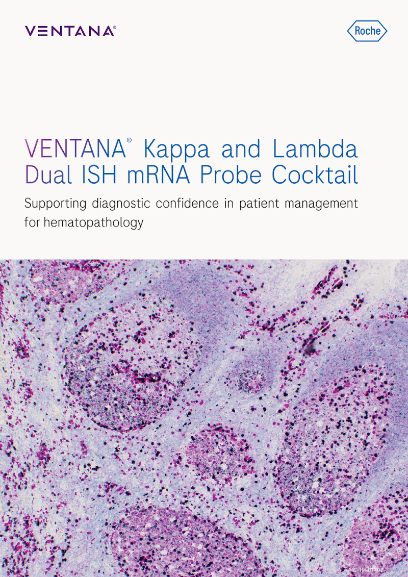 VENTANA Kappa & Lambda Dual ISH mRNA Probe Cocktail