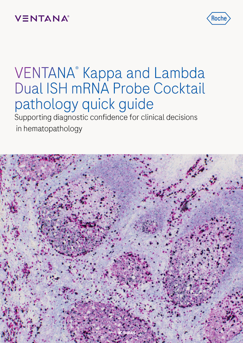 VENTANA Kappa & Lambda Dual ISH — Pathology Quick Guide