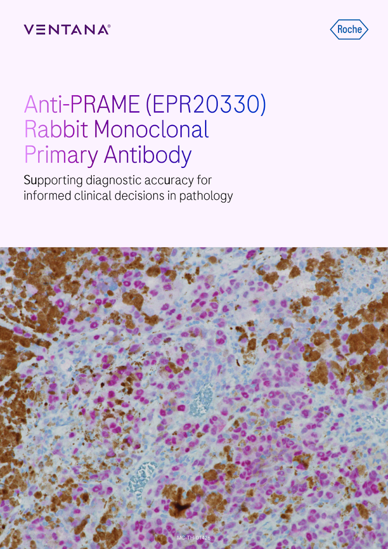 PRAME Assay Brochure