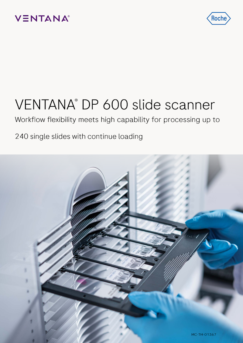 VENTANA DP 600 System